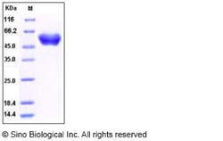 Sino Biological Human SerpinA1 / A1AT Protein (His Tag) 100ug, Quantity: