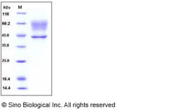 Sino Biological Recombinant Human SerpinA3 Protein (His Tag), HPLC-verified,