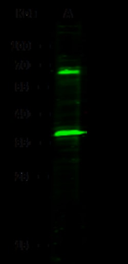 Sino Biological Anti-SerpinA3 Antibody, Rabbit Polyclonal, Quantity: Each