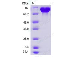 Sino Biological Human Fibronectin / Fibronectin Fragment 2 Protein (His