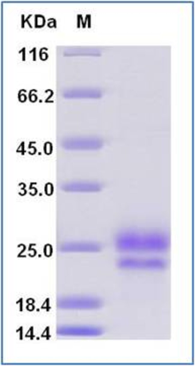 Sino Biological Human Fibronectin Protein (Domain type III EDA, His Tag
