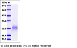 Sino Biological Human FLT3L / Flt3 ligand / FLT3LG Protein (His Tag) 1mg,