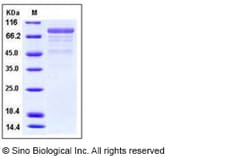 Sino Biological Recombinant Human CDH12 Protein (His Tag), Quantity: Each