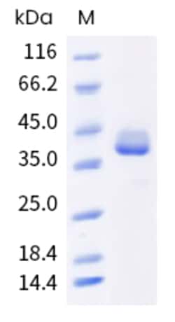 Sino Biological Human GNLY Protein 500ug (Sino Biological), Quantity: Each