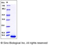 Sino Biological Human HBEGF / DTR Protein 10ug, Quantity: Each of 1