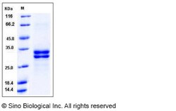 Sino Biological Recombinant Human HMGB1 Protein (His Tag), HPLC-verified,