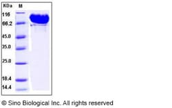 Sino Biological Recombinant Human MMP-9 Protein (His Tag), HPLC-verified