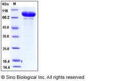Sino Biological Human MMP-9 / CLG4B Protein 100ug, Quantity: Each of 1
