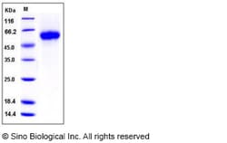 Sino Biological Recombinant Human GFR Alpha-1/GFRA1 Protein (His Tag),