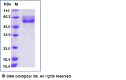 Sino Biological Human HVEM / TNFRSF14 Protein (Fc Tag) 1mg, Quantity: Each