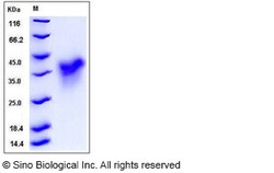 Sino Biological Human HVEM / TNFRSF14 Protein (His Tag) 100ug, Quantity: