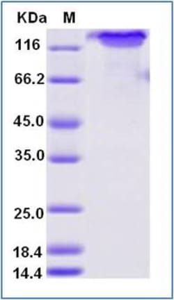 Sino Biological Human E-Selectin / SELE Protein (Fc Tag) 100ug, Quantity: