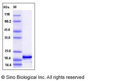 Sino Biological Recombinant Human Interferon alpha 4/IFNA4 Protein (His