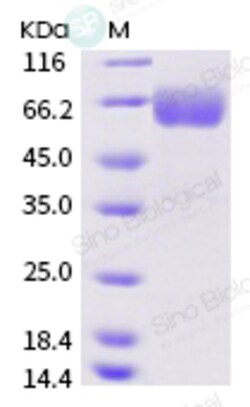 Sino Biological Recombinant Human IFNGR1 Protein (ECD, hFc Tag), Quantity: