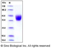 Sino Biological Recombinant Human IFNGR1 Protein (His Tag), HPLC-verified,