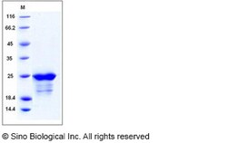 Sino Biological Recombinant Human SMAC Protein (His Tag), Quantity: Each
