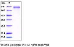 Sino Biological Recombinant Human SLITRK1 Protein (His Tag), HPLC-verified,