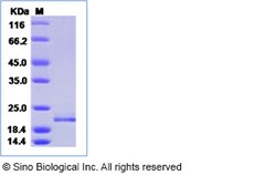 Sino Biological Recombinant Human interferon-alpha/IFNA5 Protein (His Tag),