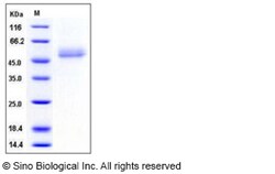 Sino Biological Human ICOS / AILIM / CD278 Protein (His & Fc Tag) 100ug,
