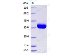 Sino Biological Human Granzyme B / GZMB Protein (His Tag) 50ug, Quantity: