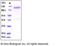 Sino Biological Recombinant Human IL-13 R alpha 2/IL13RA2 Protein (His