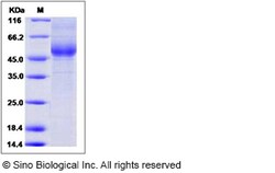 Sino Biological Recombinant Human IL-13 R alpha 2/IL13RA2 Protein (ECD,