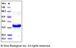 Sino Biological Recombinant Human Hsp27/HSPB1 Protein (His Tag), Quantity:
