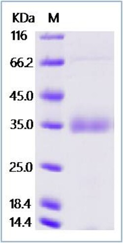 Sino Biological Human Osteopontin / SPP1 Protein (His Tag) 100ug, Quantity: