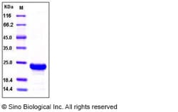 Sino Biological Recombinant Human RBP4 Protein (His Tag), HPLC-verified,