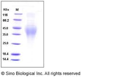 Sino Biological Human IL18BPa Protein (His Tag) 1mg, Quantity: Each of