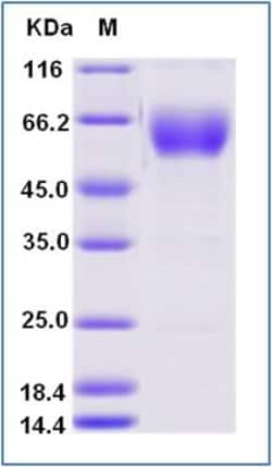 Sino Biological Recombinant Human TGF-beta RII/TGFBR2 Protein (ECD, hFc