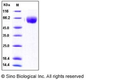 Sino Biological Recombinant Human TGF-beta RII/TGFBR2 Protein (ECD, His