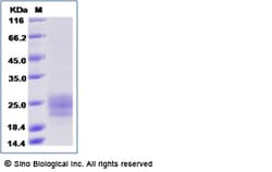 Sino Biological Human TGFBR2 Protein (ECD, His Tag) 1mg, Quantity: Each