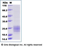 Sino Biological Recombinant Human TGF-beta RII/TGFBR2 Protein (ECD, His