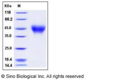 Sino Biological Human IFNAR2 / IFNABR Protein (His Tag) 100ug, Quantity:
