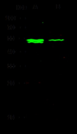 Sino Biological Recombinant Anti-Interferon alpha/beta receptor 2 Antibody,