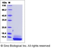 Sino Biological Human IL-15 / IL15 / Interleukin 15 Protein 10ug, Quantity: