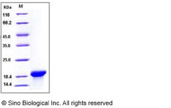 Sino Biological Human MOG Protein (aa 30-149, His Tag) 50ug, Quantity: