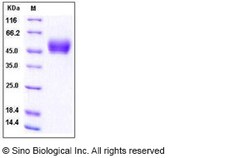 Sino Biological SARS-CoV-2 (2019-nCoV) Nucleocapsid NTD Protein (His Tag),