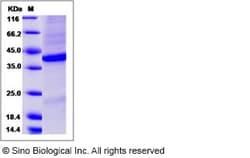 Sino Biological Recombinant Human FRZB Protein (His Tag), Quantity: Each