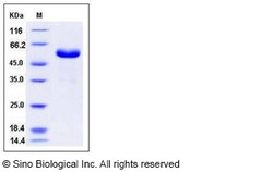 Sino Biological Recombinant Human CD32A/FCGR2A Protein (R167, hFc Tag),