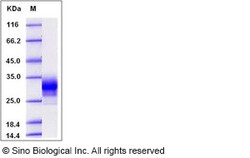 Sino Biological Human CD32a / FCGR2A Protein (167 Arg, His Tag) 1mg, Quantity: