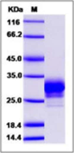Sino Biological Human CD32a / FCGR2A Protein (167 His, His Tag) 1mg, Quantity: