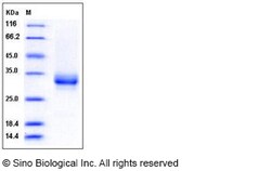 Sino Biological Recombinant Human CD32A/FCGR2A Protein (R167, His & AVI