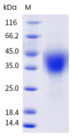Sino Biological Recombinant Human PD-1 Protein (ECD, Asp26-Pro39 deletion,