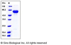 Sino Biological Recombinant Human carboxylesterase 2/CES2 Protein (His