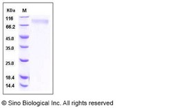 Sino Biological Recombinant Human TPO/Thrombopoietin Protein (His Tag),