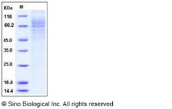 Sino Biological Recombinant Human TPO/Thrombopoietin Protein (His Tag),