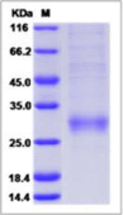 Sino Biological Human THPO Protein 1MG (Sino Biological), Quantity: Each