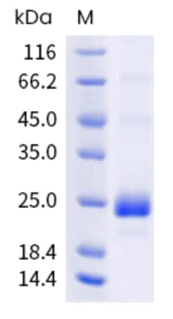 Sino Biological Human TNFSF14 Protein 1MG (Sino Biological), Quantity:
